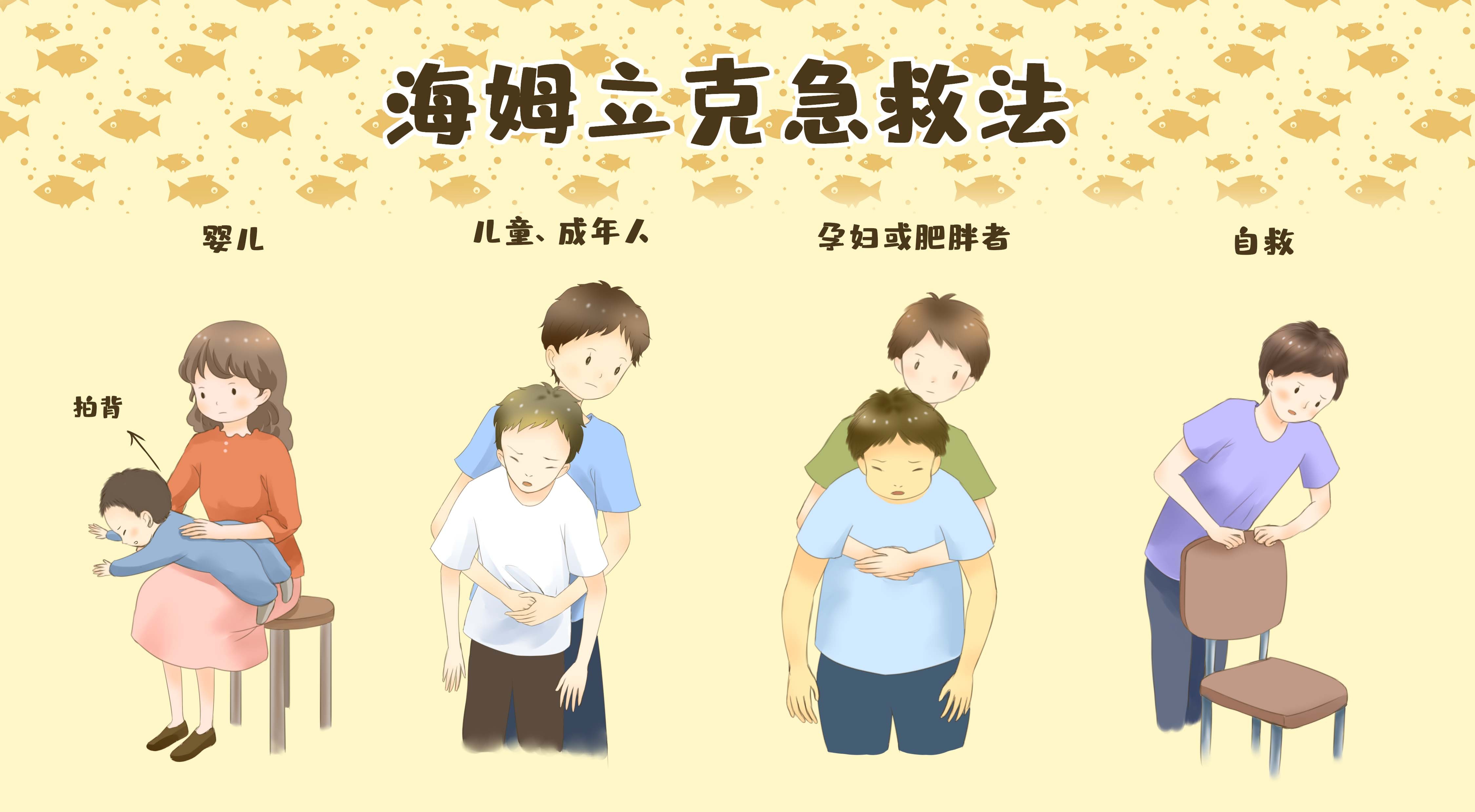 海姆立克急救方法关键时刻能救命