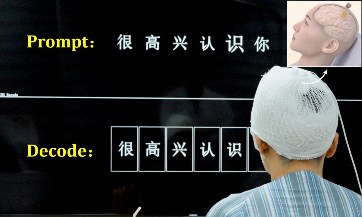 里程碑式突破！中国科学家实现脑机接口实时汉语解码与语句合成